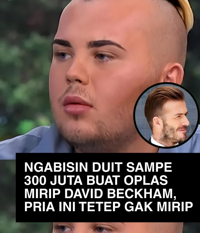 Habis Rp300 Juta Demi Mirip David Beckham